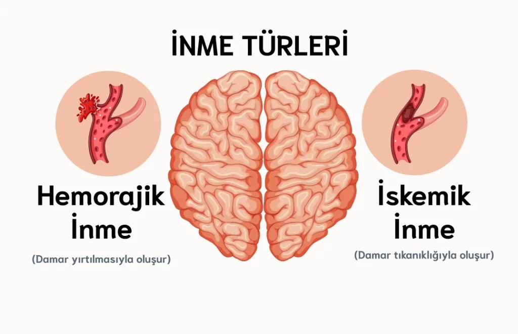 inme rehabilitasyonu. uzman fizyoterapist fahri ekin